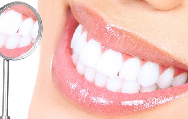 Teeth Whitening Aftercare - Lara Smile Dental Clinic