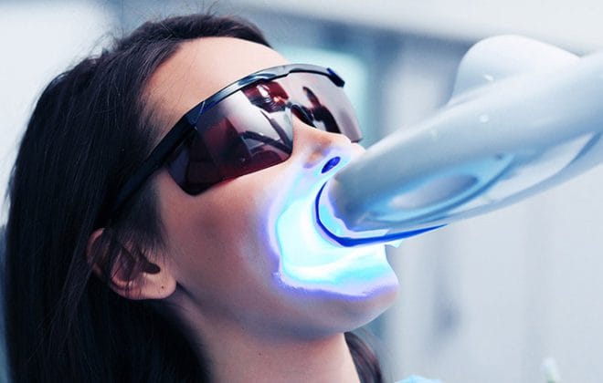 Pros of Laser Teeth Whitening