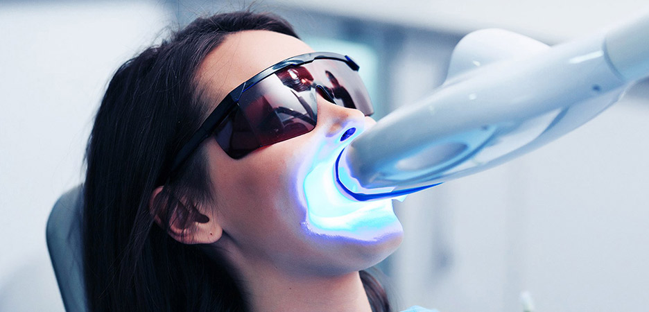 Pros of Laser Teeth Whitening