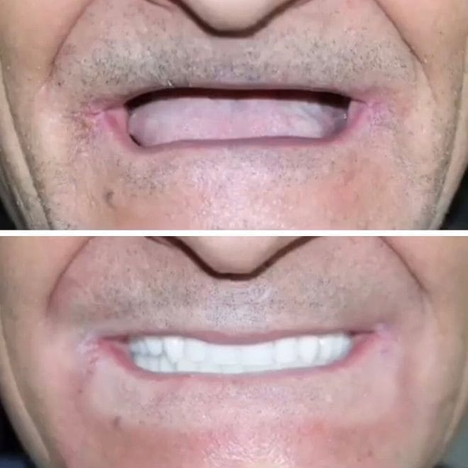 lara-smile-dental-before-after-35