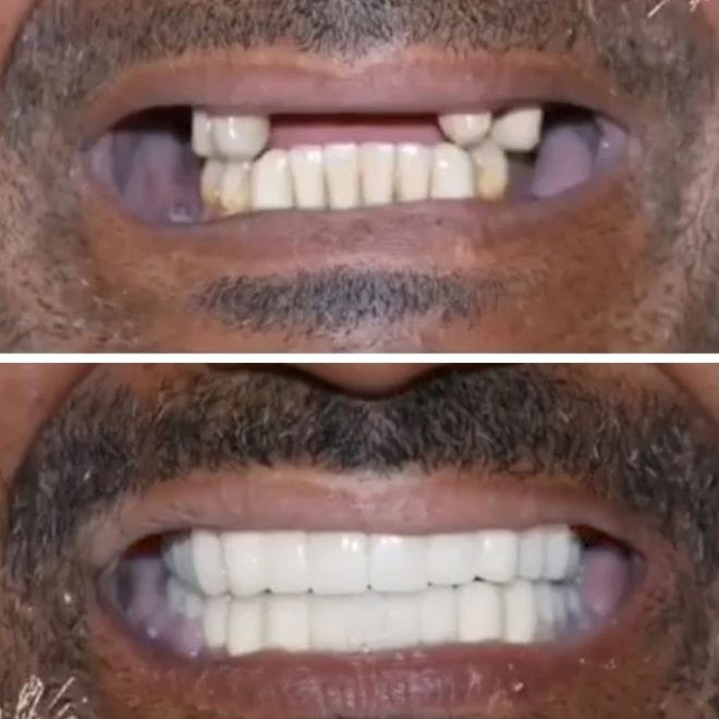 lara-smile-dental-before-after-37