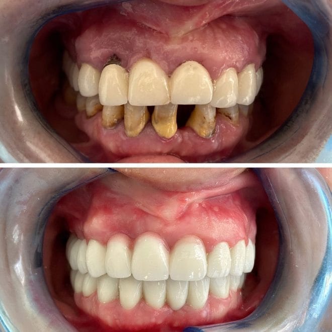 lara-smile-dental-before-after-61