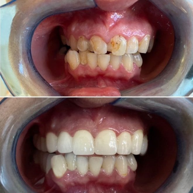 lara-smile-dental-before-after-62