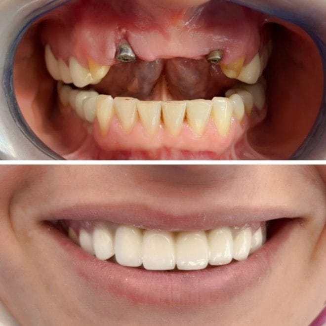 lara-smile-dental-before-after-63