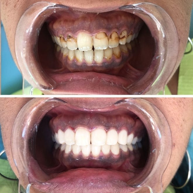 lara-smile-dental-before-after-64