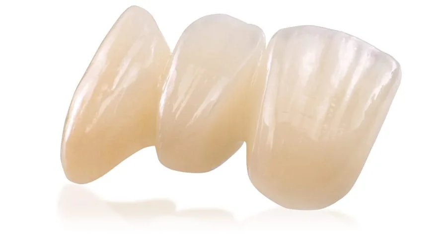 E-max Crowns