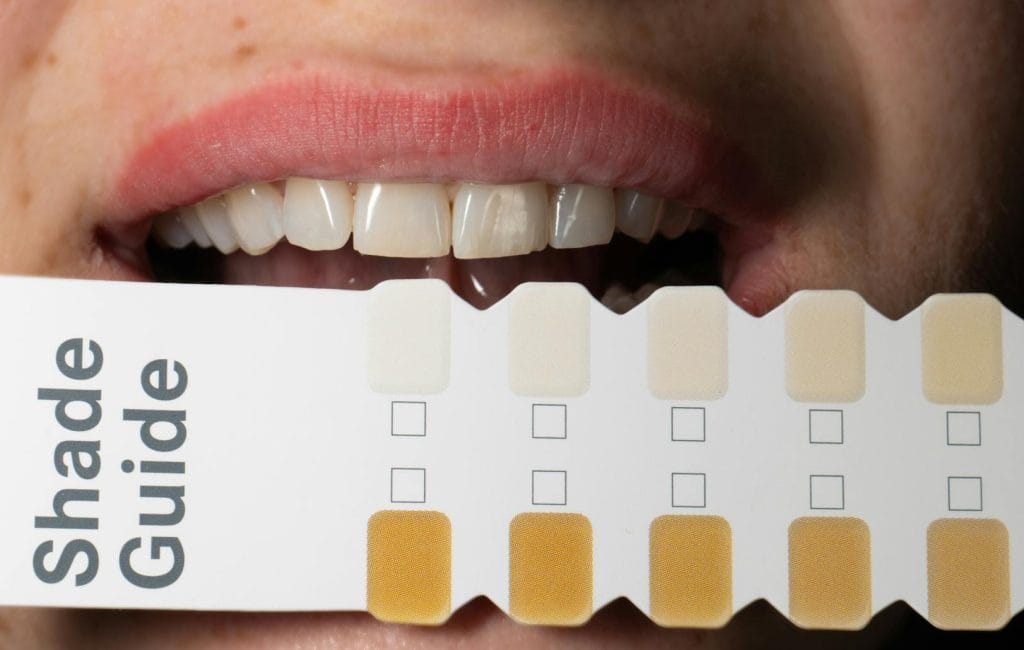 Adult holding a dental shade guide to compare tooth whitening results.