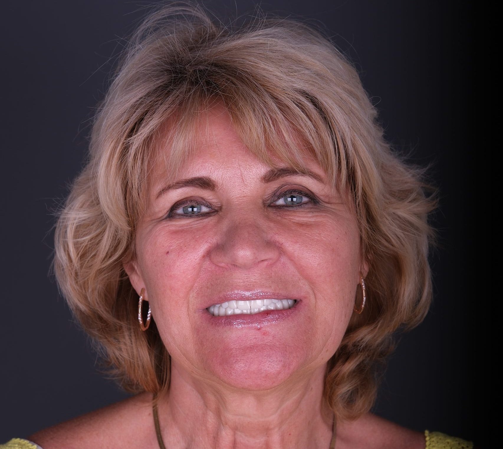 Dental implants treatment