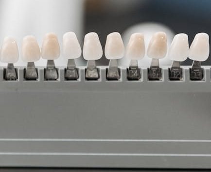 Close-up display of dental veneer samples in a holder, ideal for dentistry.