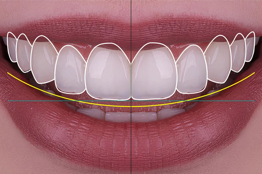 dental design turkey