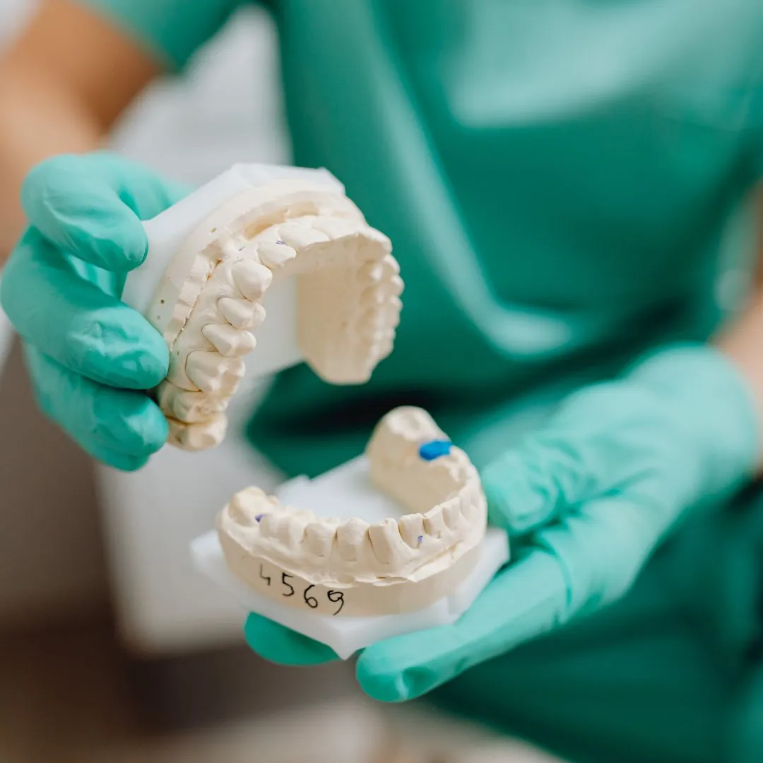 Zygomatic implant treatment visual for upper jaw bone loss