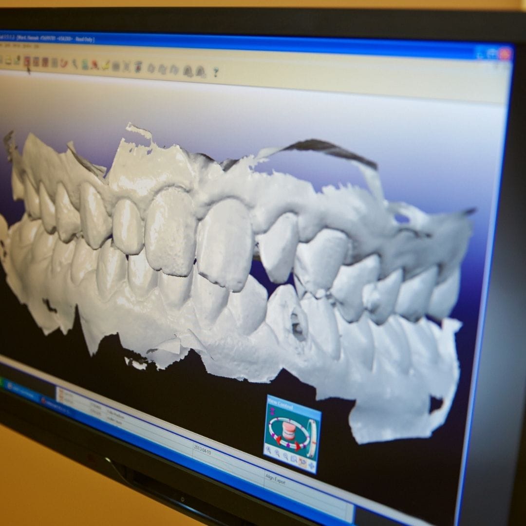 Dental Design Turkey: Smile Design in Antalya