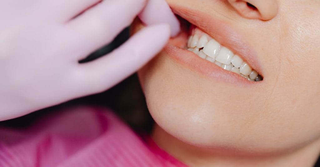 A dentist's gloved hand inspecting a patient's teeth during a check-up.