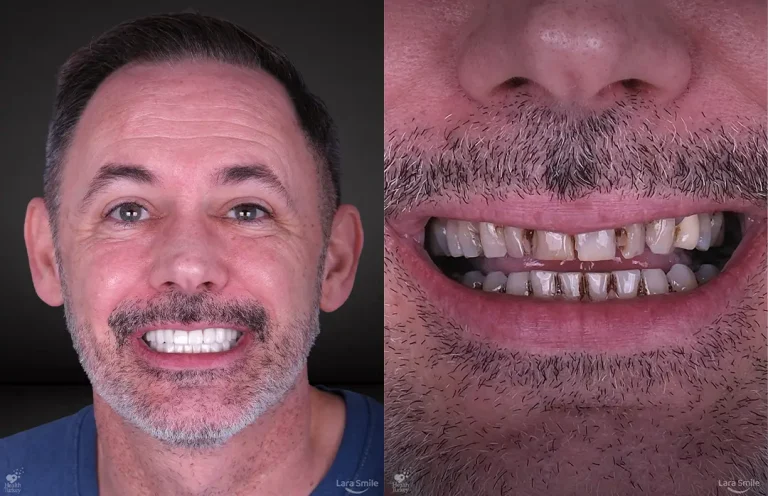 Lara Smile Dental Clinic