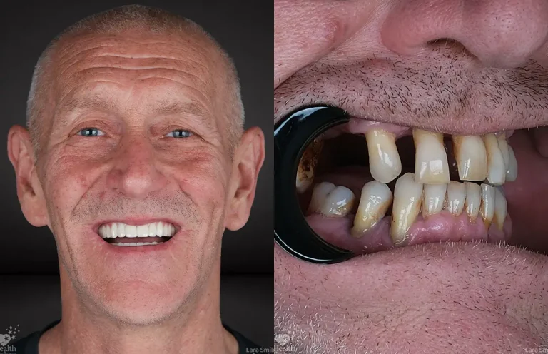 Lara Smile Dental Clinic