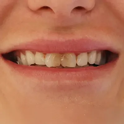 Before