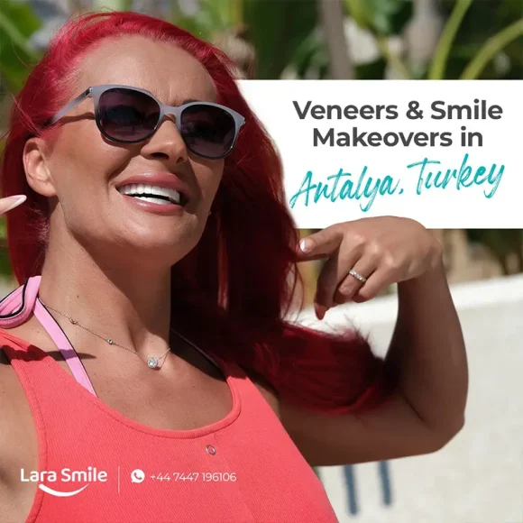 Veneers & Smile Makeovers in Antalya