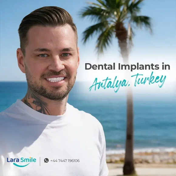 Dental Implants in Antalya, Turkey
